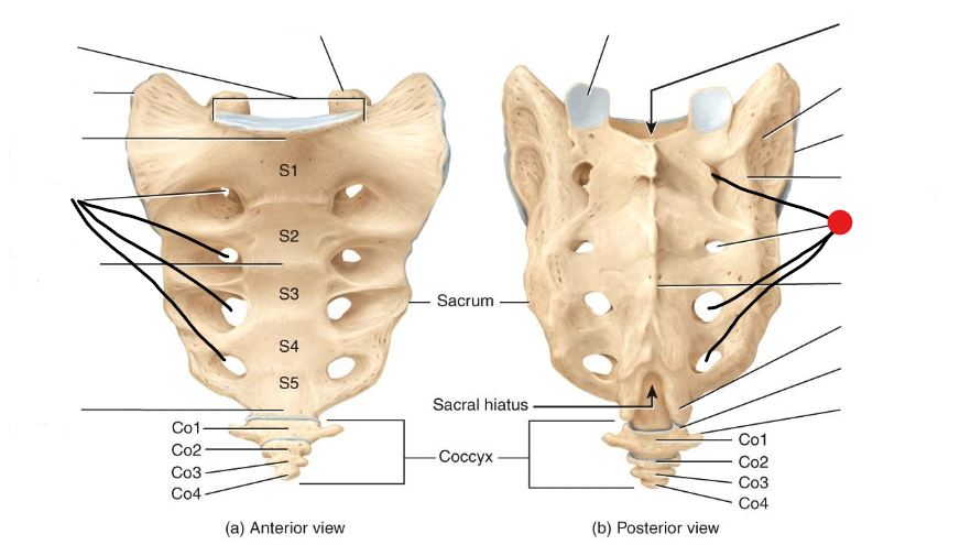 <p>Identify the structure pinned </p>