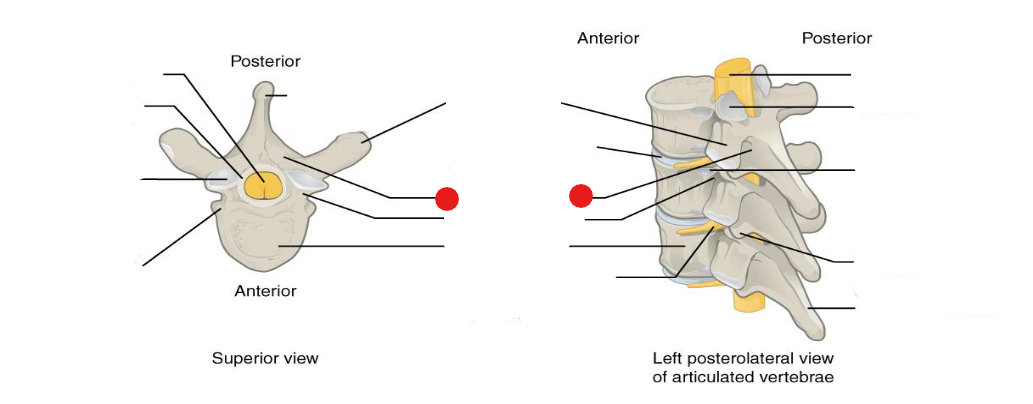 <p>Identify the structure pinned</p>