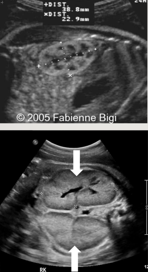 <p>what is the pathology?</p>