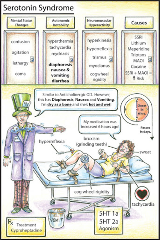 <ul><li><p>Life threatening increase in serotonergic CNS activity from drug interactions, therapeutic use, or intentional OD</p></li><li><p>Classic triad </p><ul><li><p>Altered mental status </p></li><li><p>Autonomic hyperactivity </p></li><li><p>Neuromuscular abnormalities (clonus, hyper-reflexia, lower extremity rigidity) </p></li></ul></li></ul><ul><li><p>Treatment </p><ul><li><p>Benzodiazepines for sedation </p></li><li><p>Cyproheptadine (serotonin antagonist) → more definitive  </p></li></ul></li></ul><p></p>