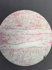 <p>Longer than wide, nucleus close to the basement membrane</p><p>FOUND IN LINING OF KIDNEY COLLECTING TUBULES</p>