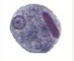 <p>What Amaeba is this?</p>