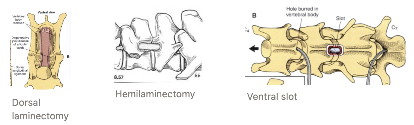 <ol><li><p><strong>Dorsal laminectomy</strong> = Removal of vertebral lamina (vertebral bone dorsal to spinal cord)</p><ul><li><p><u>Indication:</u> Dorsal lesions → NOT discs as too ventral</p></li></ul></li><li><p><strong>Hemilaminectomy</strong> = Removal of vertebral lamina on ONE side and lateral to the spinal cord</p><ul><li><p><u>Indication:</u> Disc disease</p></li></ul></li><li><p><strong>Ventral slot</strong> = Removal of rectangular portion of bone and intervertebral disc ventral to spinal cord → Push everything out of the way first</p><ul><li><p><u>Indication:</u> Access cervical vertebrae</p></li></ul></li></ol><p></p>