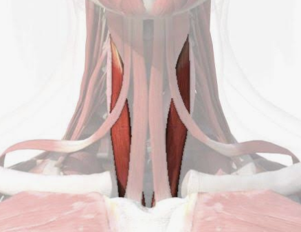<p>Which muscle is this?</p>