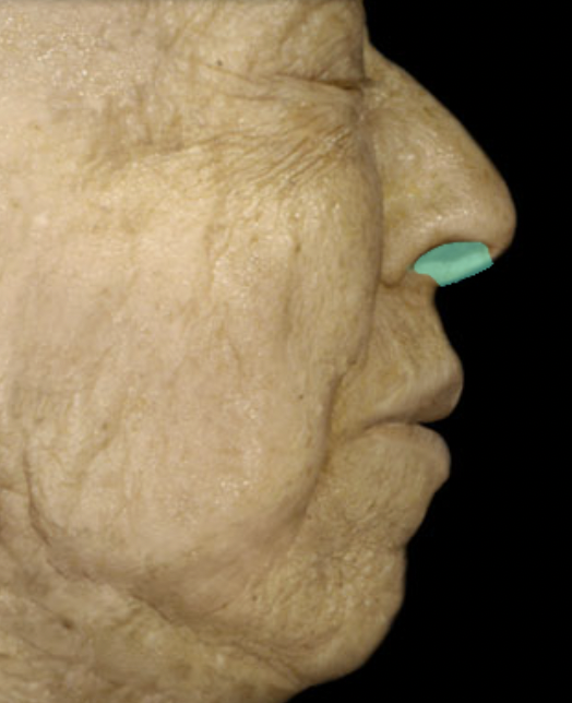 <p>Identify the feature of the nasal cavity</p>