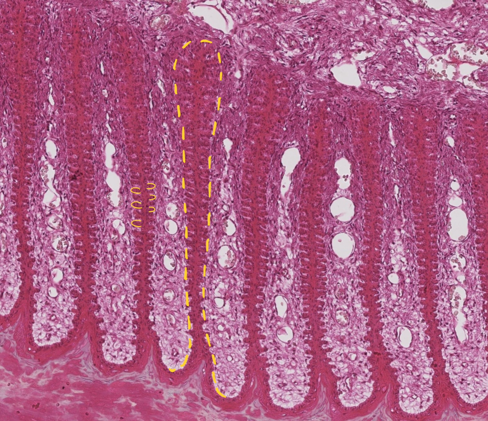 <ul><li><p>make up inner layer of the hoof wall</p></li><li><p>create a massive surface area for attachment</p><ul><li><p>suspends &amp; anchors distal phalanx within the hoof</p></li></ul></li><li><p>600 parallel lamellae that interdigitate with dermal lamellae of the corium</p><ul><li><p>each primary laminae give rise to 100 secondary epidermal lamellae</p></li></ul></li></ul><p></p>