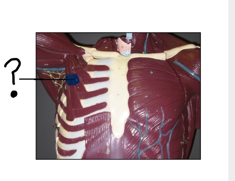 <p>Muscle name, origin, insertion, and actions</p>
