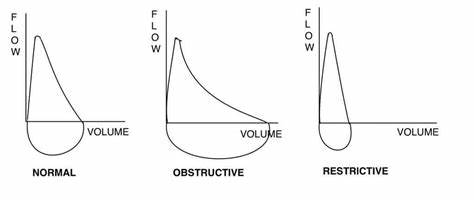 <p>concave vs normal shape but reduced overall volume</p>