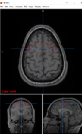<p>primary motor cortex</p>