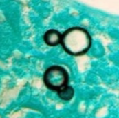 <p>dimorphic, lollipop conidia, broad based budding yeast</p>