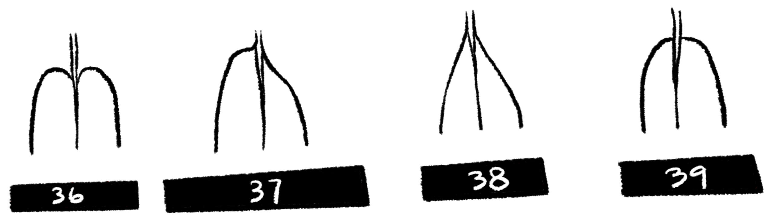<p>What is 38?</p>