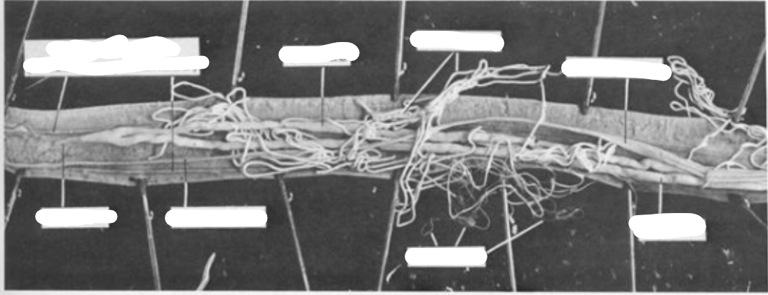 <p>What is this parasite </p>