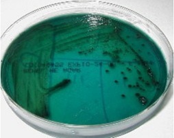 <p>What is the Gram reaction and microscopic morphology of an organism growing on this HE&nbsp;plate?</p>