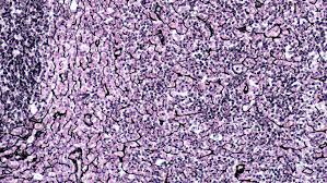 <p>which type of connective tissue is this?</p>