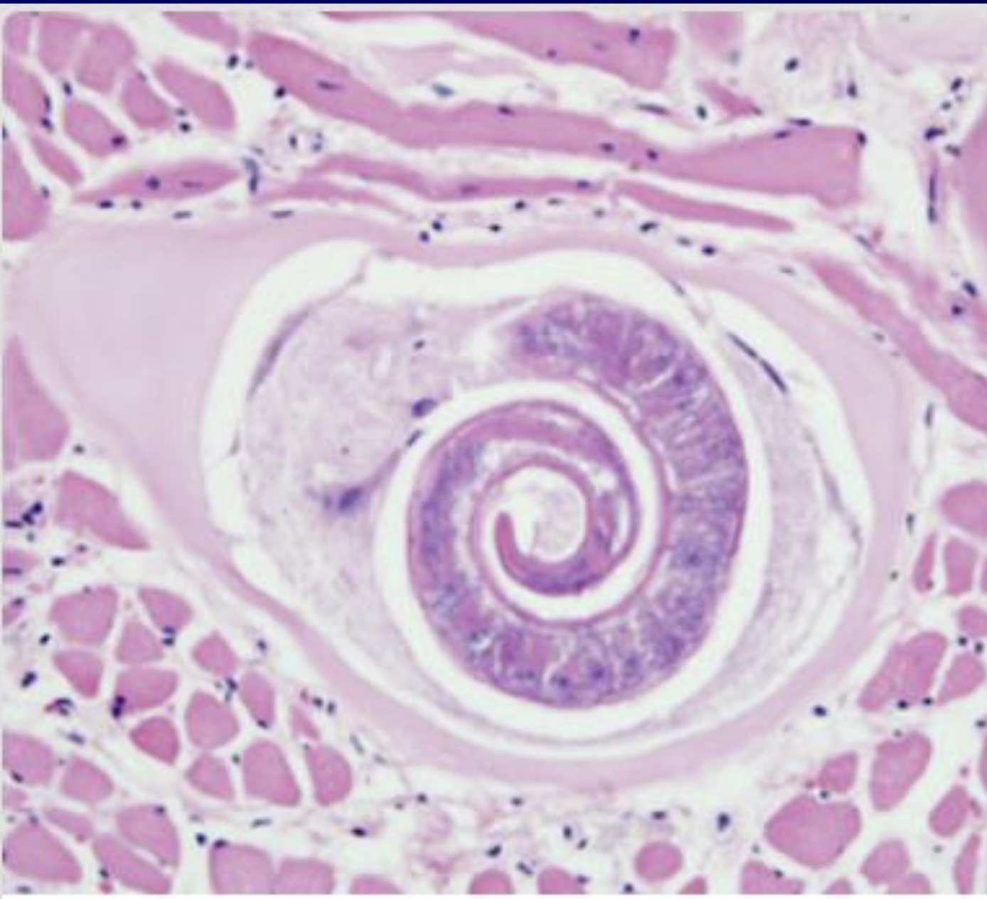 <p>Name this parasite species?</p>