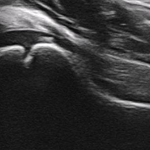 <p>Identify this image. </p>