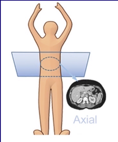 <p>As though the patient is supine and you are looking through the feet in axial view</p>