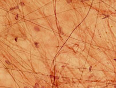 <p>identify the tissue</p>