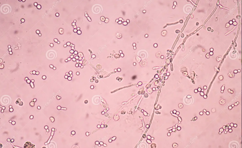 <p>The microscopic organism below may be mistaken for which microscopic element?</p>