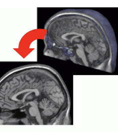 <p>What is this view of the brain?</p>