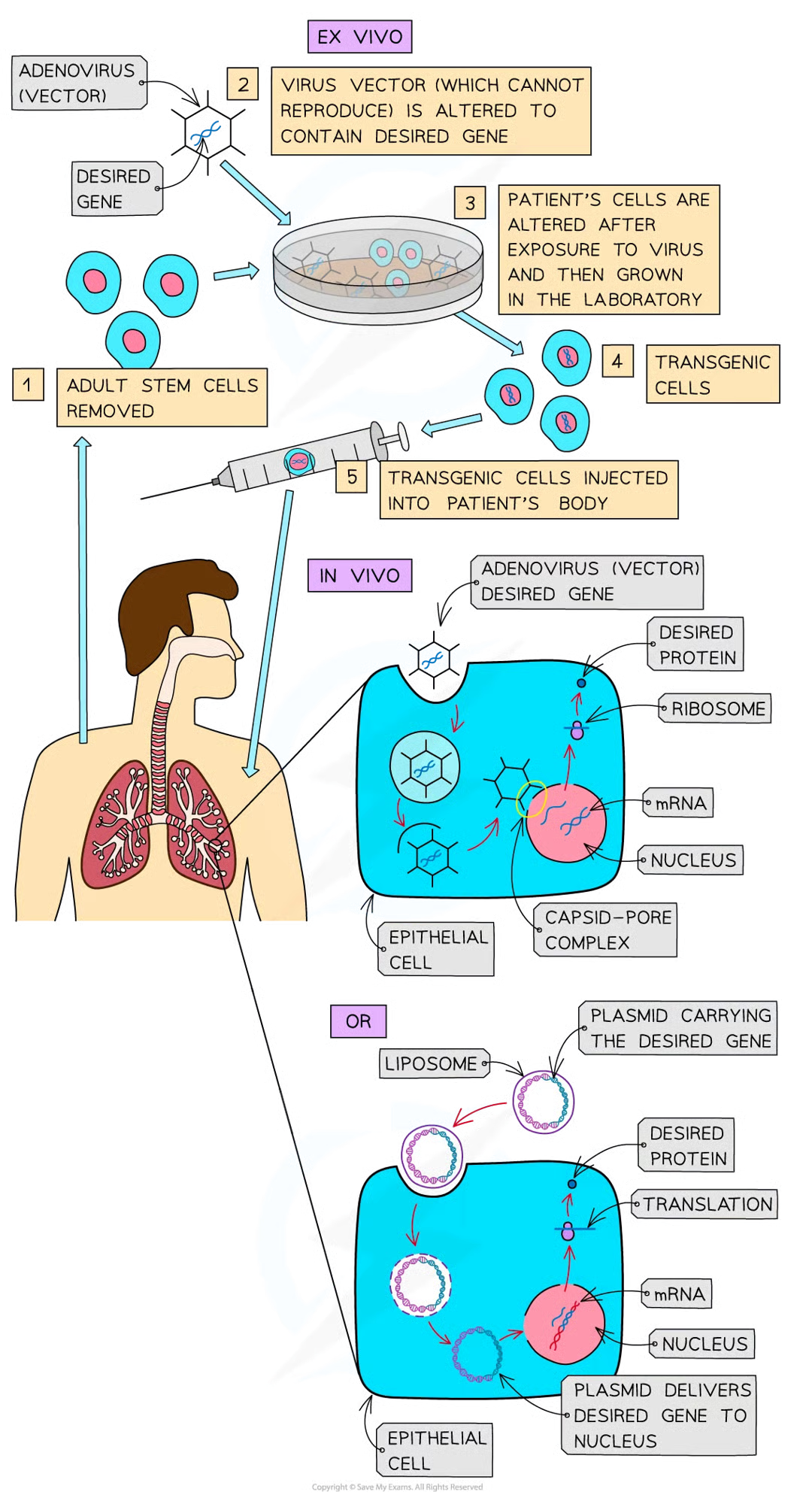 <ul><li><p>ex vivo - new gene inserted via virus vector into cell outside body</p><ul><li><p>blood or bone marrow clels extracted and exposed to virus which inserts gene into cells</p></li><li><p>these cells grown in lab and returned to person by injection into vein</p></li></ul></li><li><p>in vivo - new gene inserted via a vector into cells inside the body</p></li></ul><p></p>