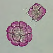 <p>Acacia pollen</p>