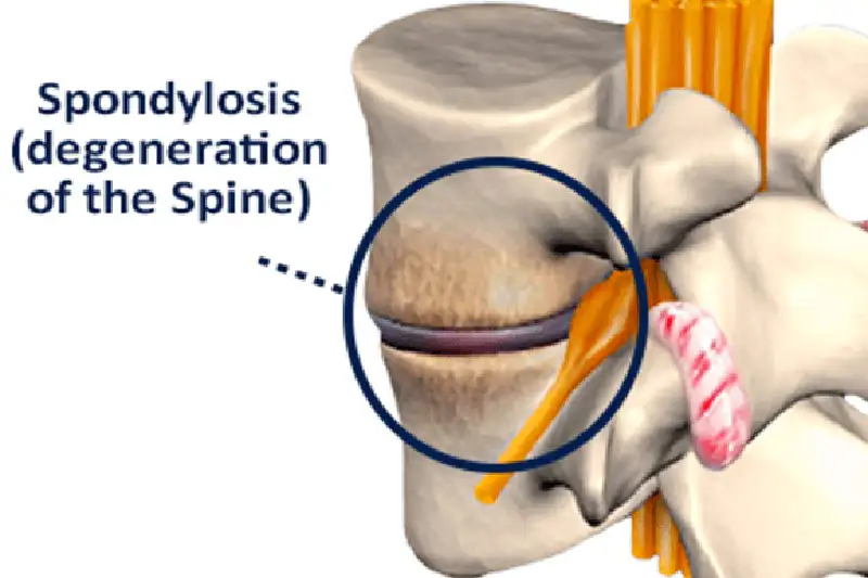 <p>What injury / condition? </p>