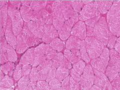 <p>Identify</p>