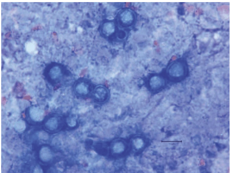 <p>-Broad based budding yeast (BBB) often with double contours</p><p>-Mold form is not very distinct</p>