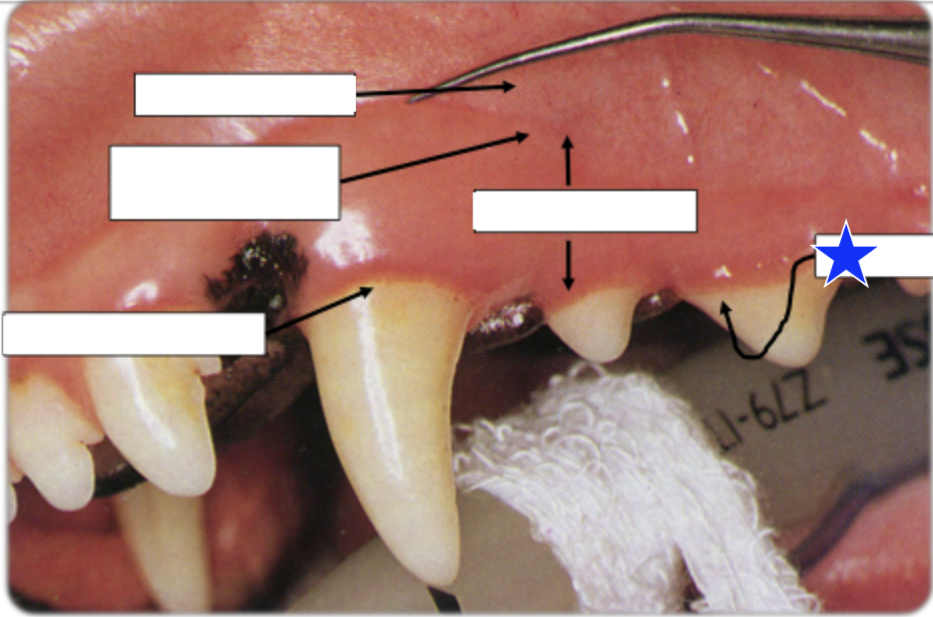 <p>What part of the gingiva is indicated by the star?</p>