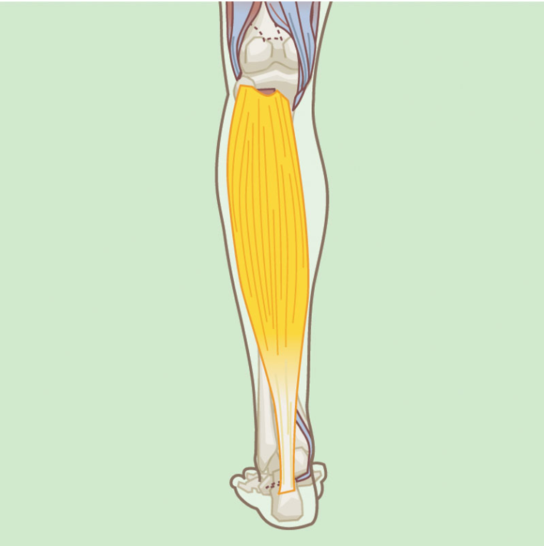 <p>What muscle is this?</p>