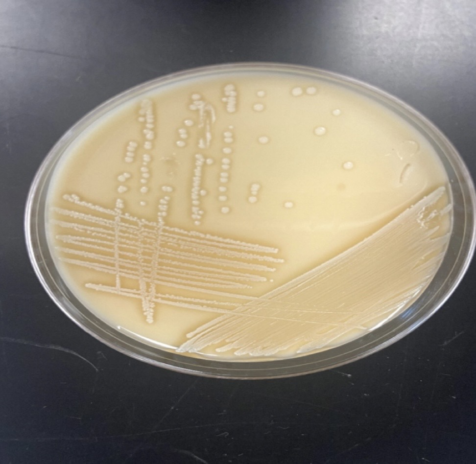 <p>Staphylococcus epidermidis</p>