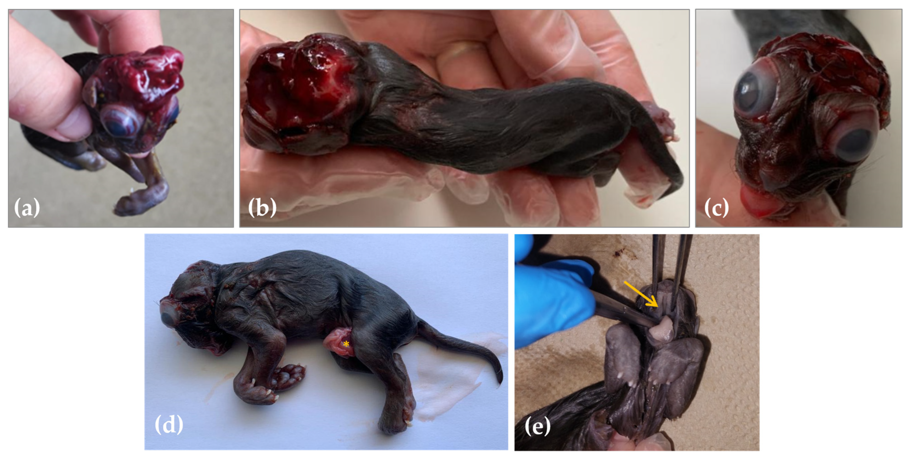 <p>ANENCEPHALY</p>