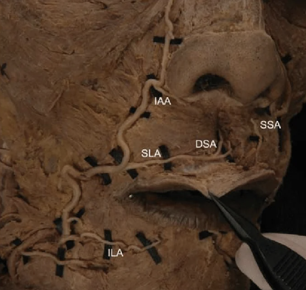 term image