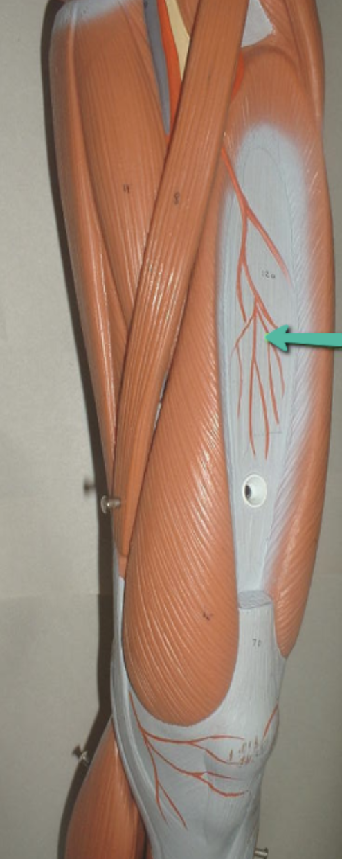 <p>Identify the muscle indicated by the pointer.</p>