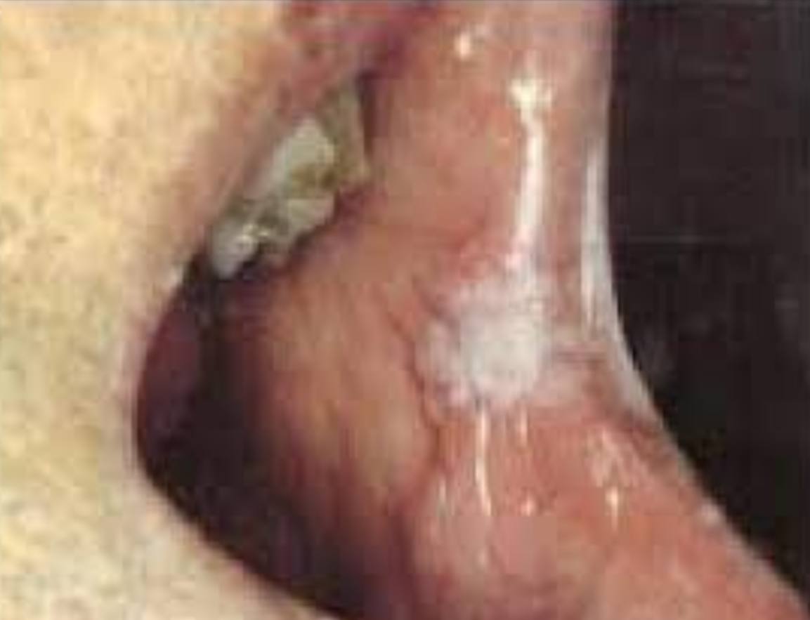 <p>• Name of lesion:</p><p>• Causative organism:</p><p>• Describe the lesion:</p>