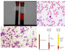 <p>How can you diagnose IMHA?</p>