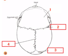 <p>What structure is 3?</p>