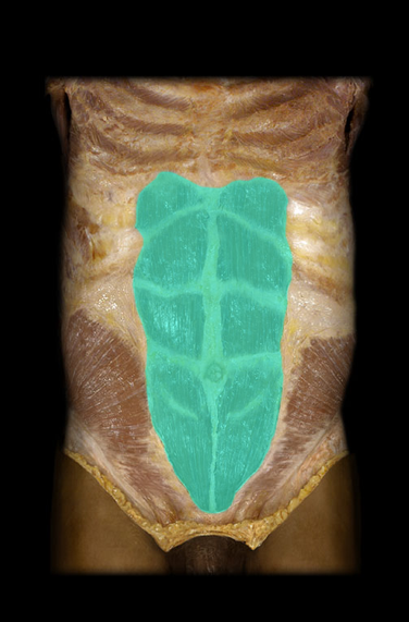 <p>Rectus abdominis m.</p>