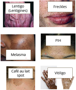 <p>Macules and Patches</p>