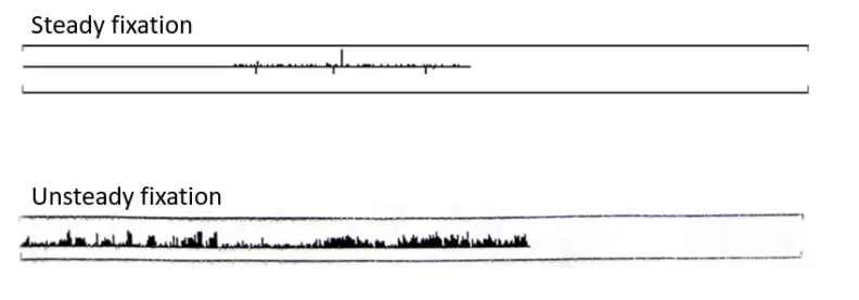 <p>used with fixation loss measure to monitor fixation stability</p>