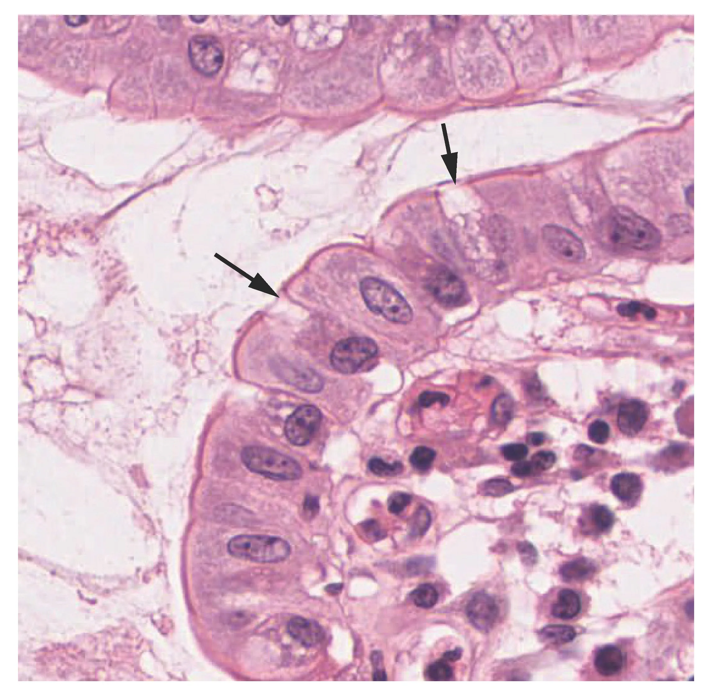term image