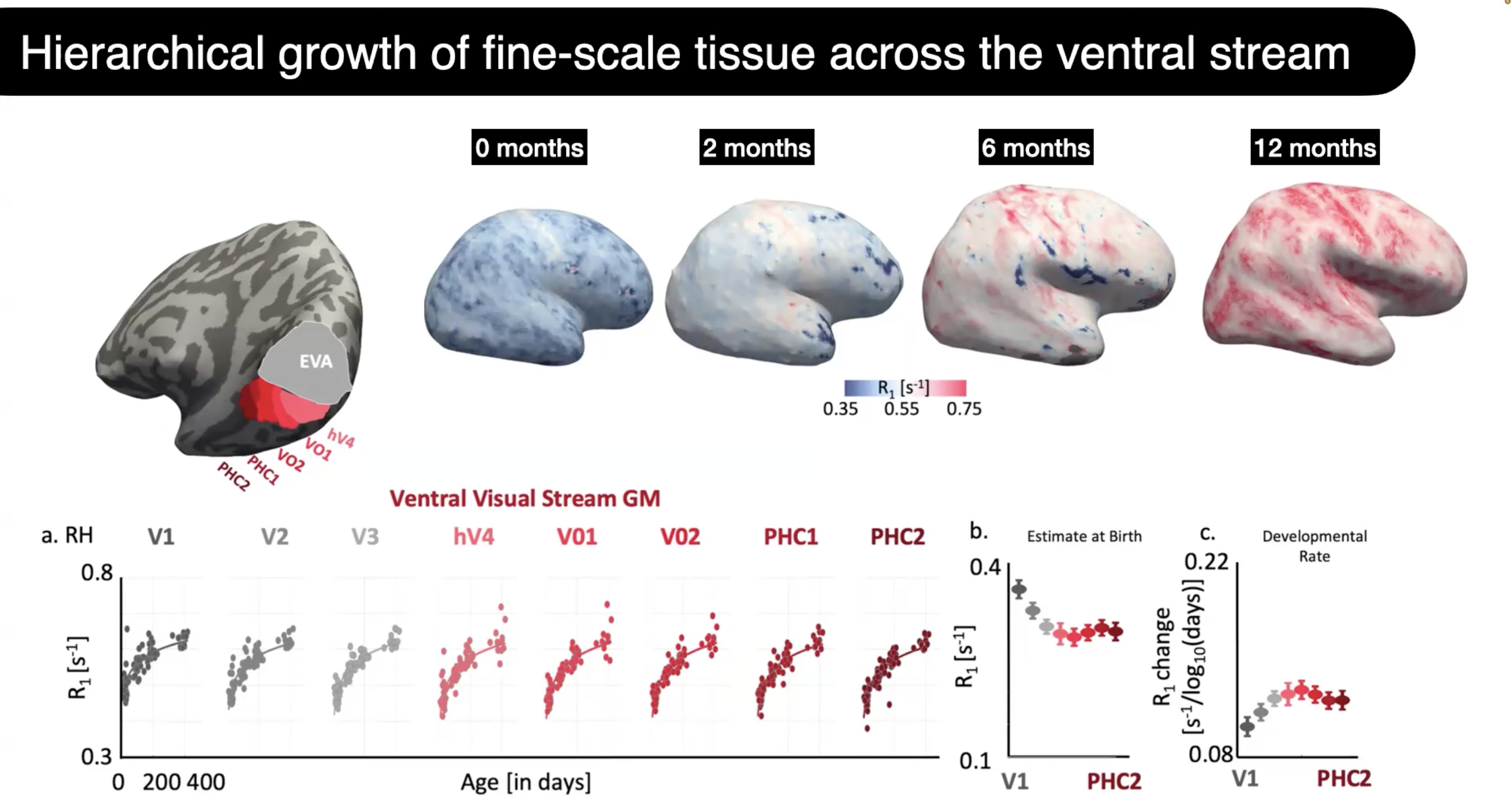 R1 higher in primary regions, slope higher in higher level regions