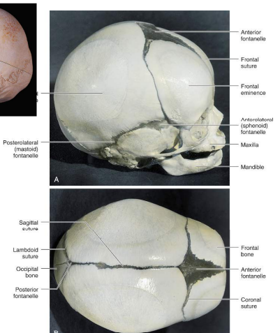 <p>Broader areas of connective tissue that eventually become sutures, allowing for brain growth and deformation during birth:</p><ul><li><p>anterior</p></li><li><p>anterolateral</p></li><li><p>posterior</p></li></ul><p></p>