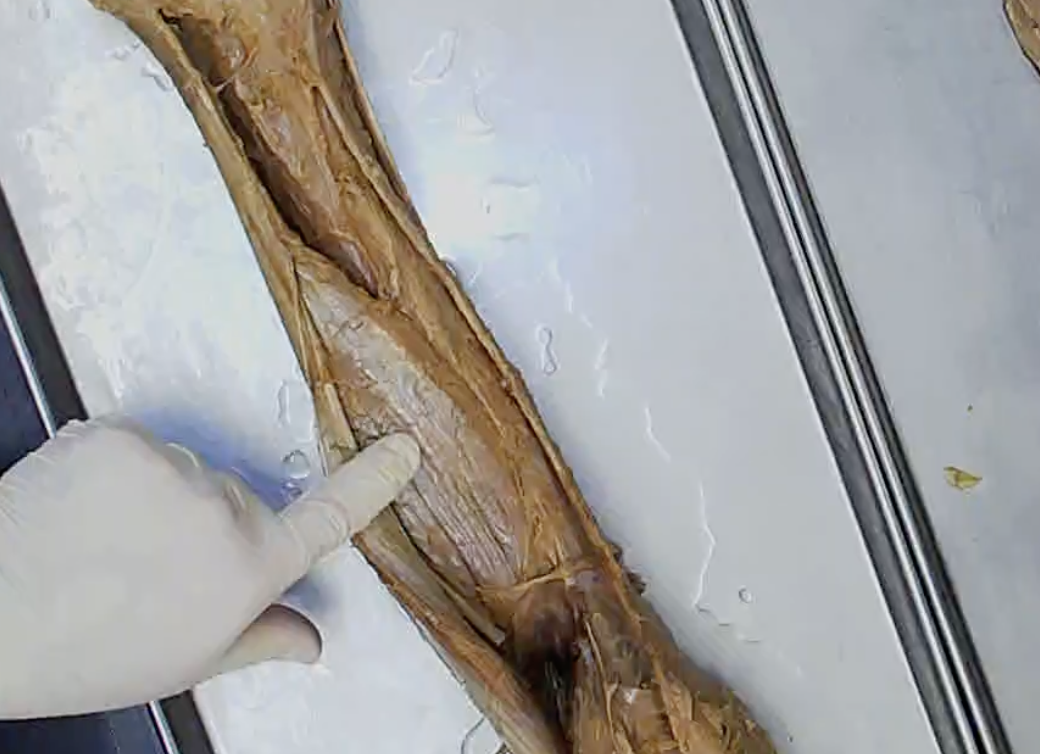 <p>Where he is pointing</p>