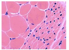 <p>What is Atrophy?</p>