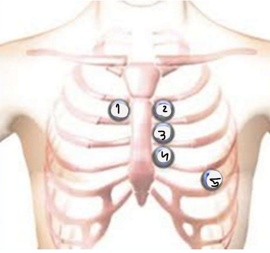<p>Name the 5 traditional areas for heart palaption/ausltation</p>