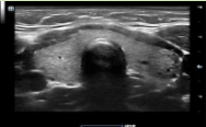 <p>FOV: rectangular </p><p>Used for vascular, small parts</p>