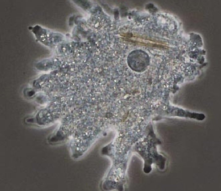 <p>What protist is this?</p>