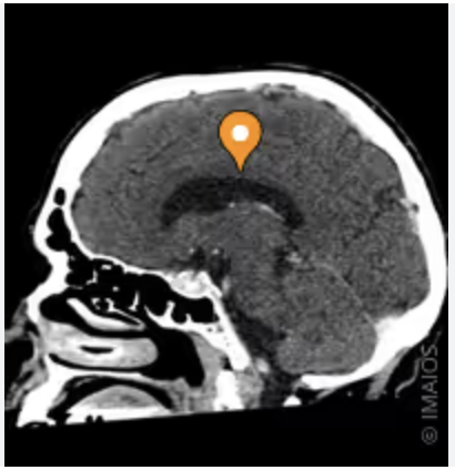 <p>Name the part of the brain, the modality, and the plane</p>